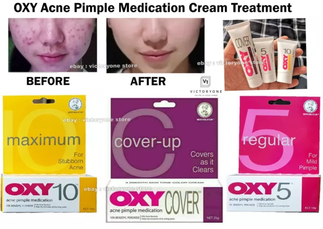 Treatment Face Acne Pimple Medication Cream OXY 5/10 Cover up - Benzoyl Peroxide