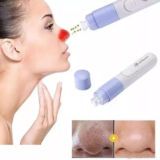 Aspirateur Point Noirs Extraction Multifonction Nettoyant Facial 3