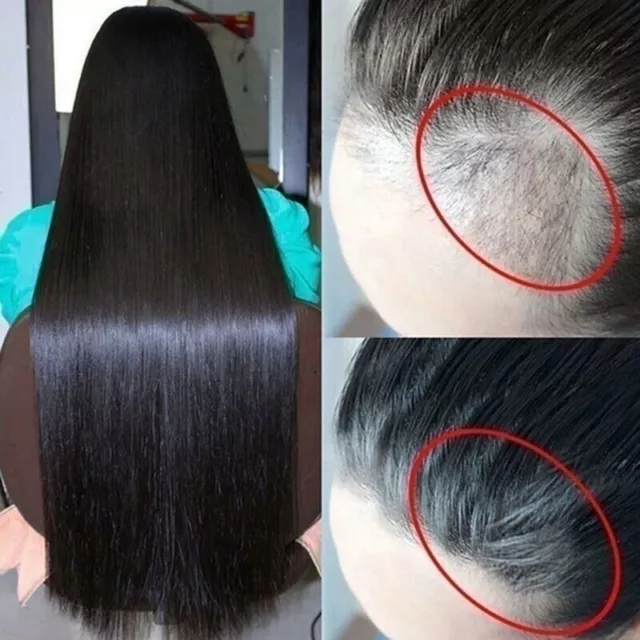 New Rice Water Hair Growth Shampoo Anti Hair Loss Treatment Serum Conditioner