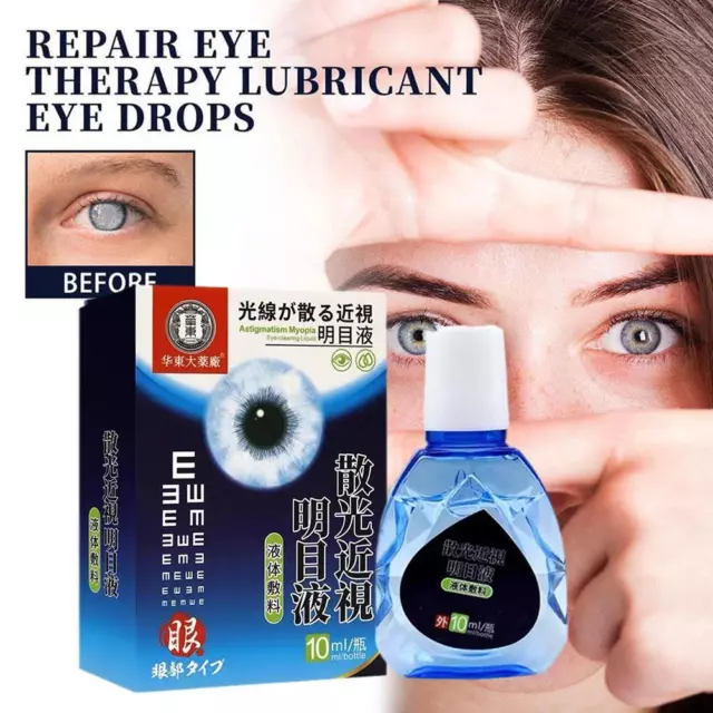 gotas para los ojos astigmatismo miopía;