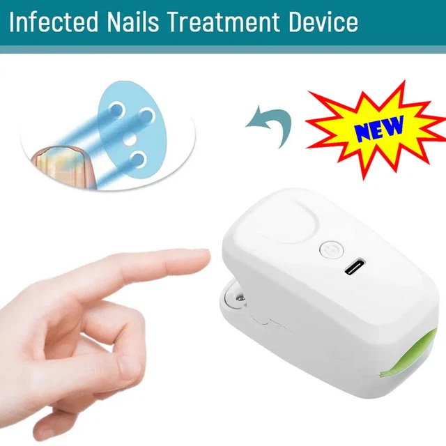 Nail Fungus Laser Treatment Device Fingernail Toes InfectionsCleaning Remover N