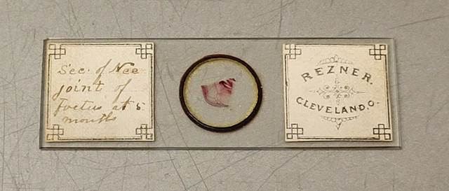 Antique 1800's Rezner Cleveland Ohio Microscope Slide 5 Month Fetus Knee Sec.