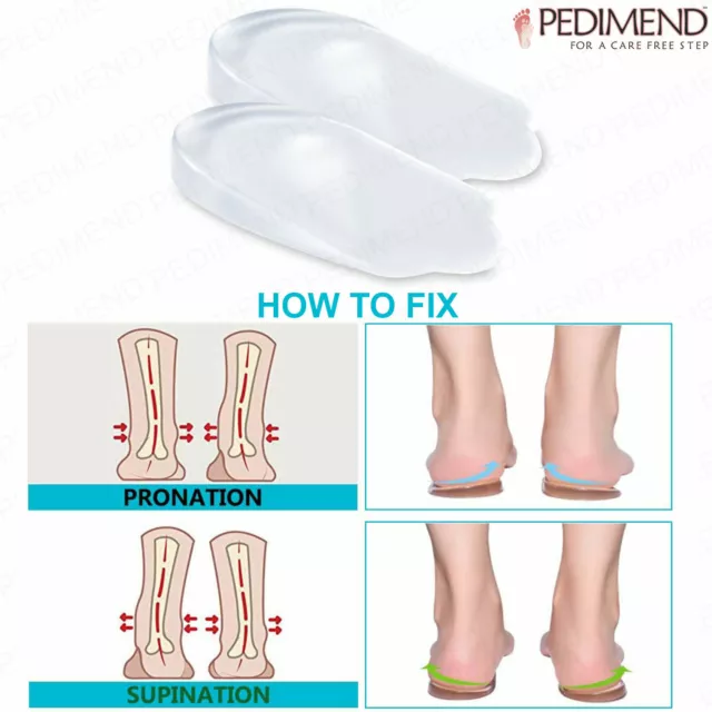 Pedimend™ 2x Supination and Pronation Corrective Heel Insoles for O/X Type Legs 2