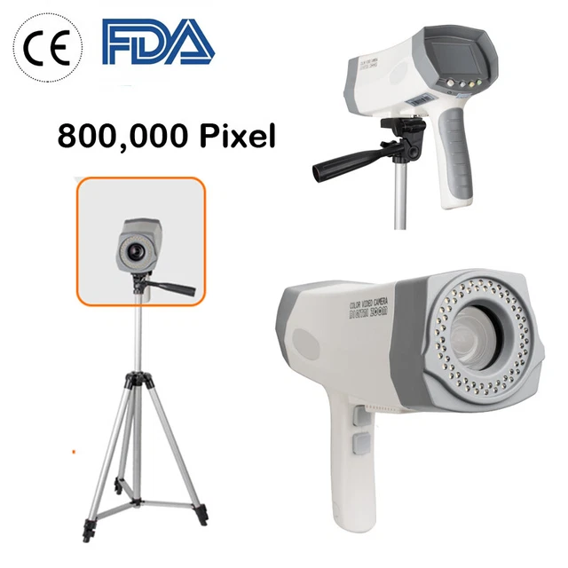 Carejoy NEW Electronic Colposcope Vagina Mirror+Sony Camera+LED Handle+Tripod