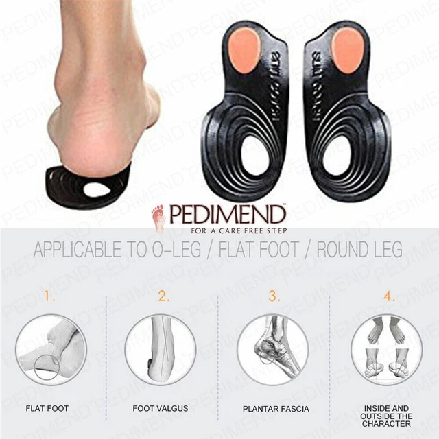 Shoe inserts for intoeing on sale