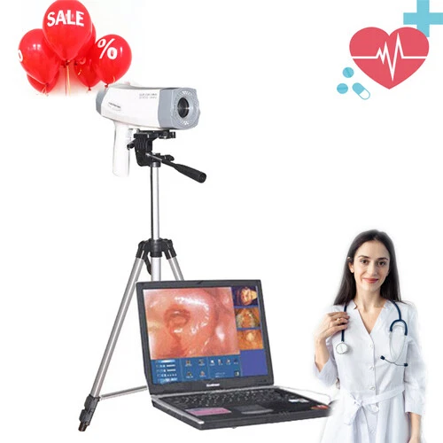 Carejoy  Surgical Video Colposcope  SONY Camera High Definition +Stand +Tripod