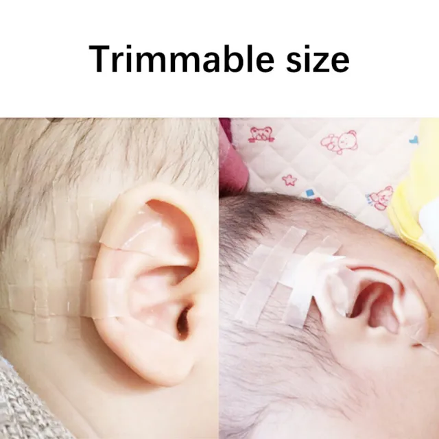 Correctores estéticos para orejas bebé recién nacido pegatinas para parche para orejas niños bebé sobresaliente