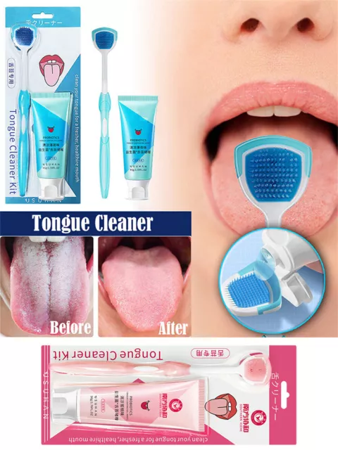 Tongue Tounge Cleaner Scraper Dental Hygiene Oral Mouth Tongue Cleansing Gel UK