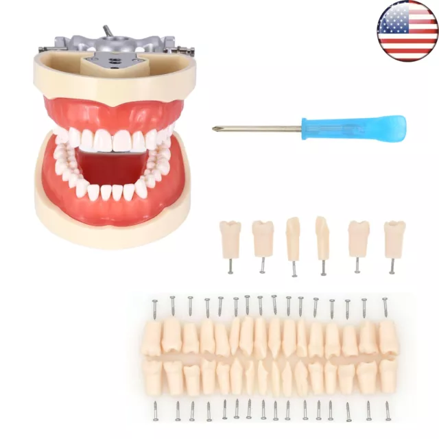 US Kilgore Nissin 200 Type Dental Typodont 32Pcs Replace Screw-in Teeth Model