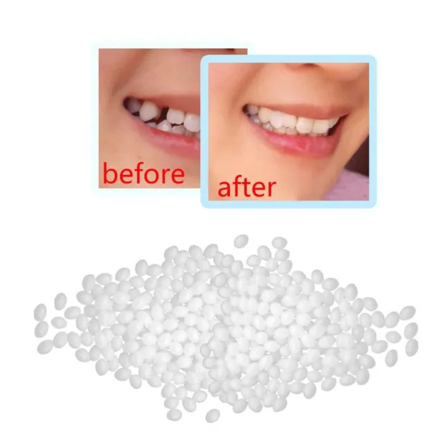 Solid Glue Denture Adhesive Temporary Tooth Repair Kit Teeth And Gaps FalseTeeth