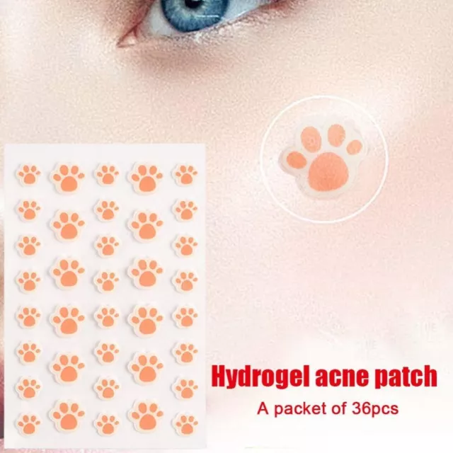 36 pz/set patch acne artiglio gatto bellezza strumento acne invisibile