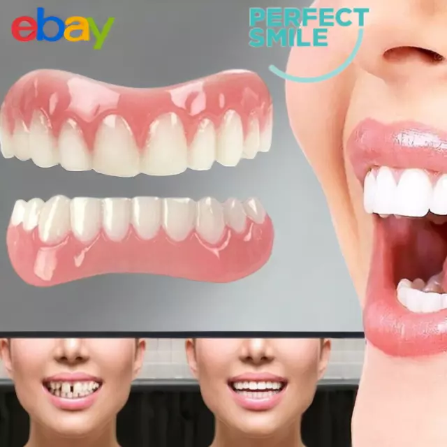 Veneers Falsche Zähne einrasten sofort Lächeln Veneers Kosmetik Zähne Zahnersatz Zahnprothesen