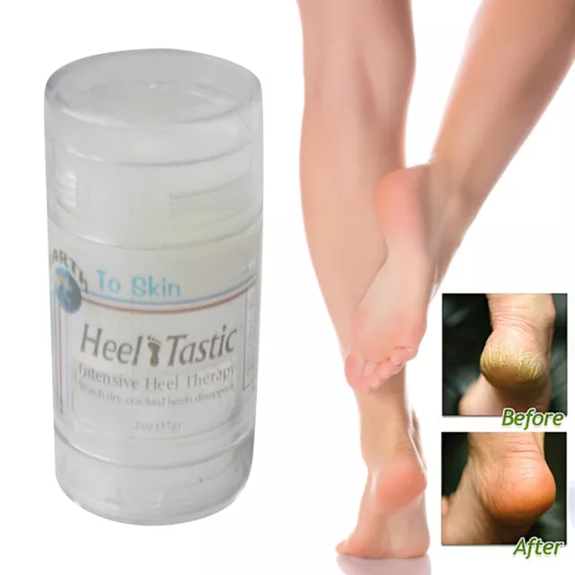 Cracked Heel Repair-Balm 2oz,Foot Paste For Dry Cracked Feet Heel Care Lotion AU