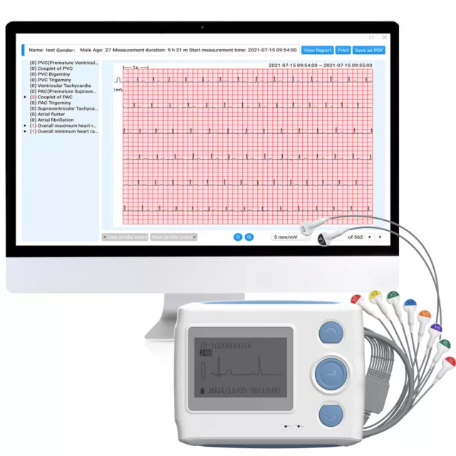 Holter Cardiaco ECG 12 derivazioni con Rapporto di Analisi AI e software per PC