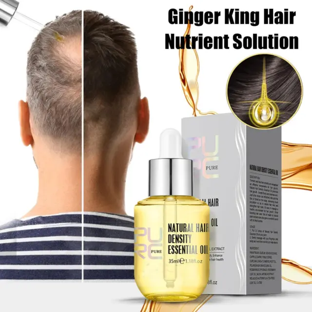 Ginger Essence Hair Growth Products Fast Regrowth Oil Loss Hair Medicine n Y4J0