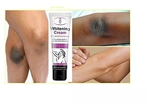 Crema Blanqueadora De Piel, Crema Aclaradora Para Áreas Ínti