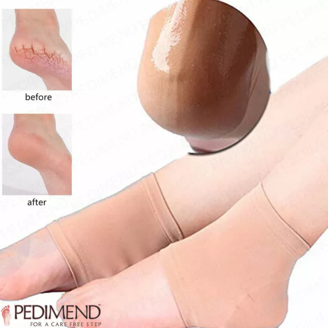 Pedimend Moisturizing Silicone Gel Heel Socks for Dry Hard Cracked Skin (2 PC)