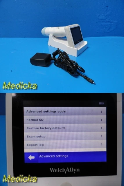 Welch Allyn RetinaVue 100 Imager Non-Mydriatic Fundus Camera W/ Dock & PSU~31168