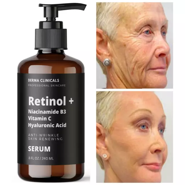 8oz - Retinol, Niacinamide, Vitamin C, Hyaluronic Acid, AntiAging Wrinkle SERUM