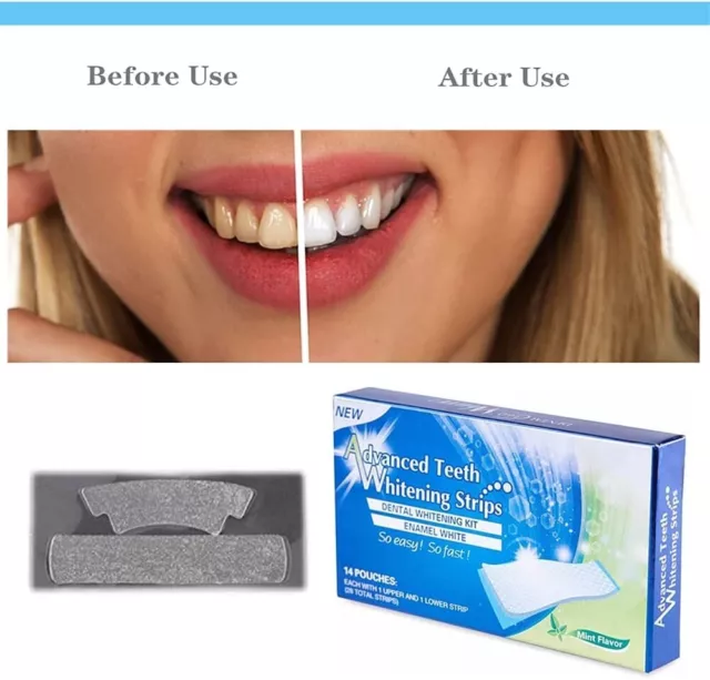 Professional Advanced Teeth Whitening Strips Home Tooth Bleaching Uk