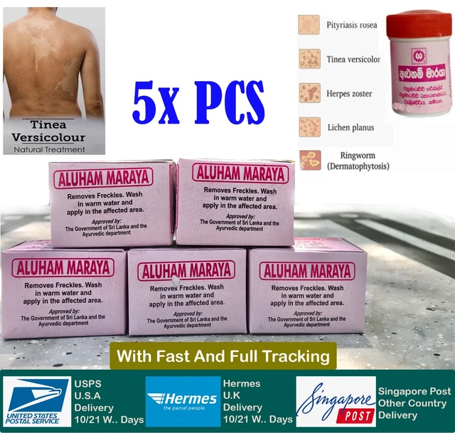 5XPCS TINEA VERSICOLOR ANTIFUNGAL Pityriasis Relief Herbal Cream Treat