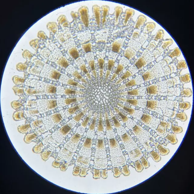 J.D. Moller Microscope Slide Sea Urchin Echinus Esculentas L. Helgoland Germany