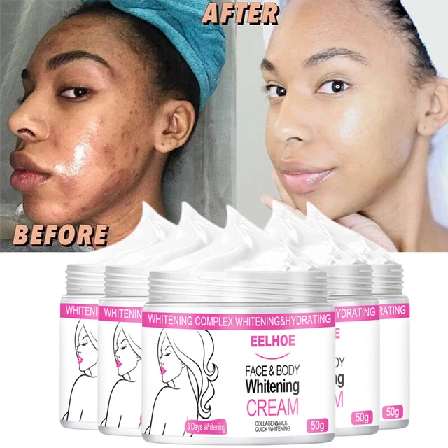 DARK SKIN PERMANENT Bleaching Cream Fast Whitening Lightening
