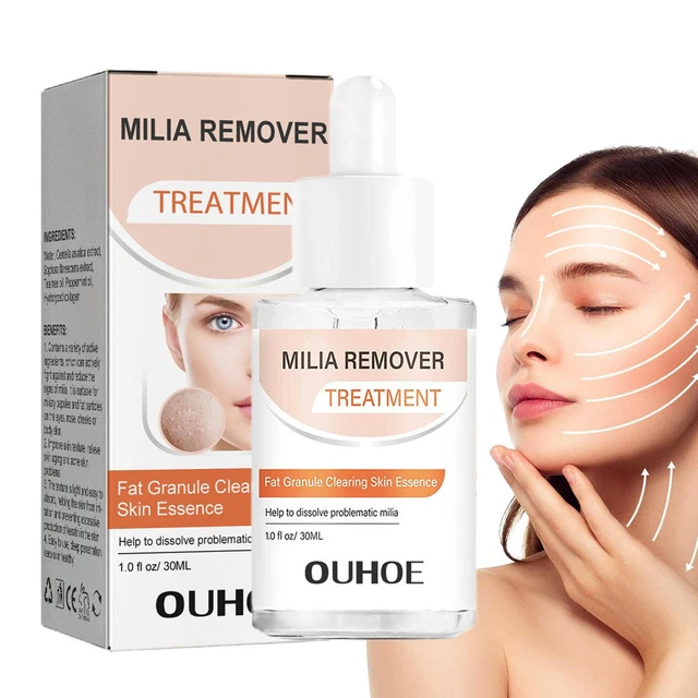 30 ml removedor de suero Milia tratamiento de manchas Milia ayuda a disolver y reducir la protuberancia de aceite