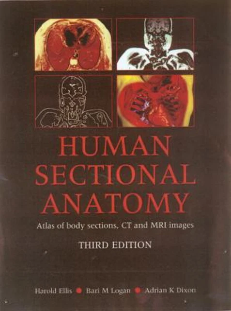 HUMAN SECTIONAL ANATOMY : Atlas of Body Sections, CT and MRI Imag £14. ...