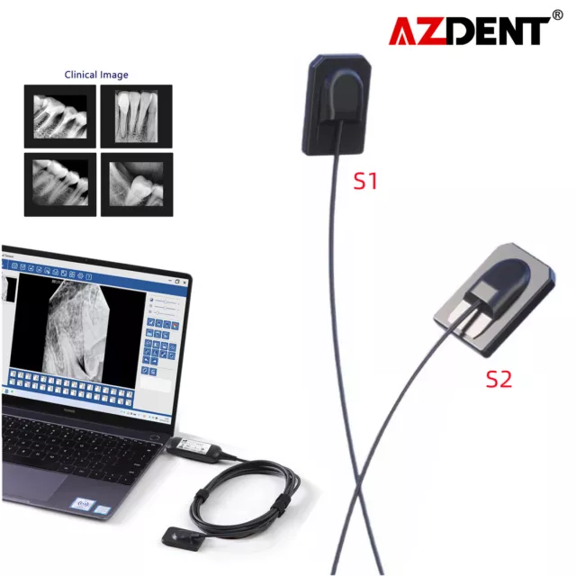 Sensor digital de rayos X dental sistema digital en la cavidad tamaño de la má