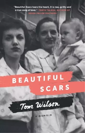 Tom Wilson Beautiful Scars (Poche)