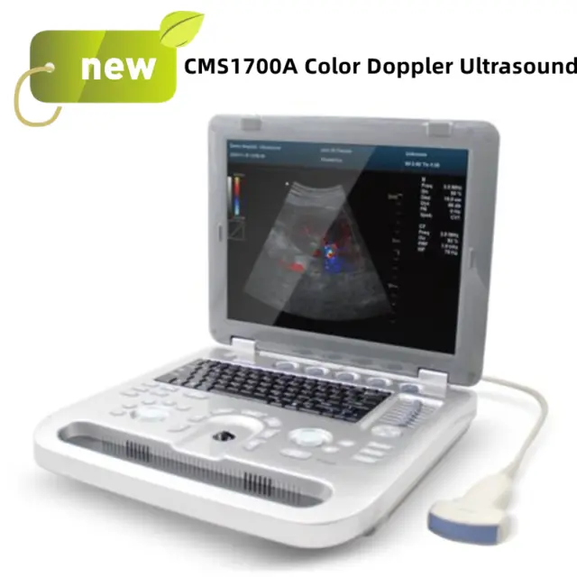New Color Doppler CMS1700A Ultrasound Scanner 3.5Mhz Convex Probe Abdominal