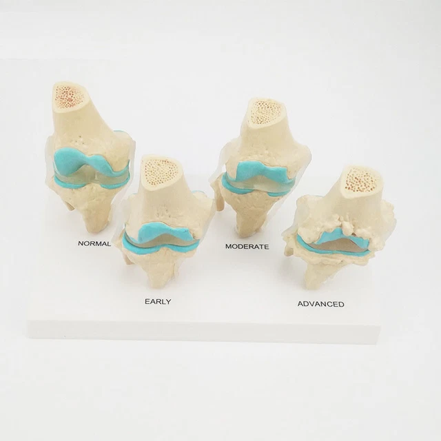 1:1 Life Size  Human Hip Joint Muscle Anatomical Model Surgery Biology Medical Supplies