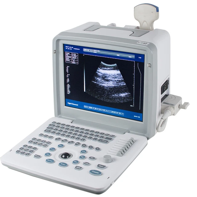 PORTABLE DIGITAL ULTRASOUND Scanner Convex Transducer 3D Module