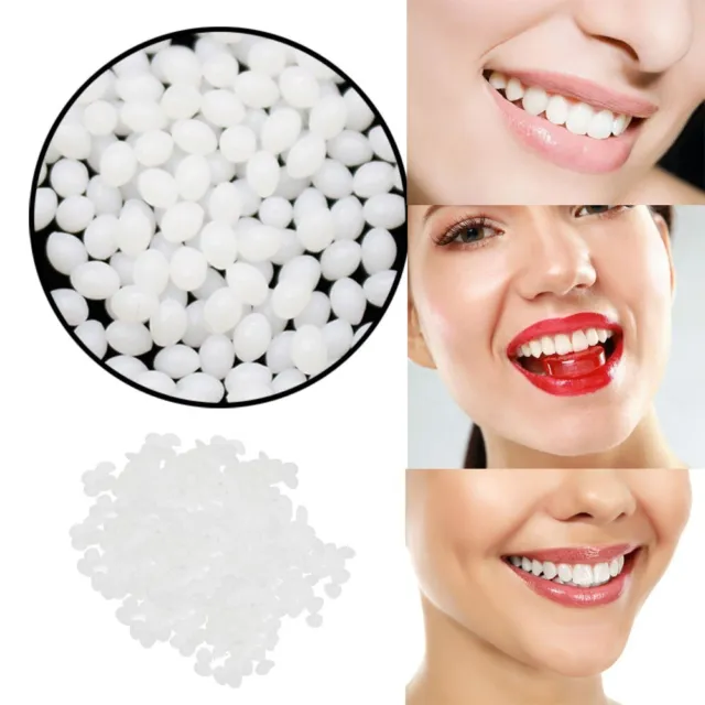 Kit de reparación dental temporal dientes y huecos dientes postizos pegamento sólido adhesivo dental
