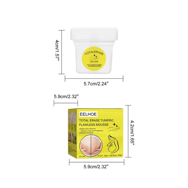 STRETCH MARK CREAM Pregnancy Repair Scar Line Abdomen Cream Remove