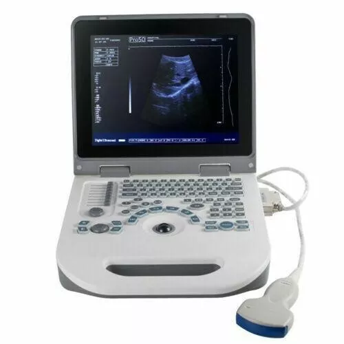 12" Portable Laptop Full Digital Ultrasound Scanner Machine with Convex Probe 3D