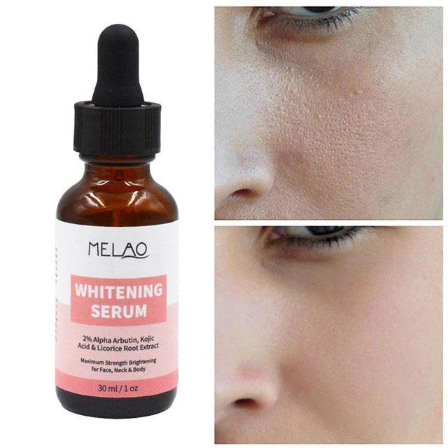 30 ml Blanqueamiento de la Piel Aclaramiento Suero Oscuro Punto S0F7 N1A2