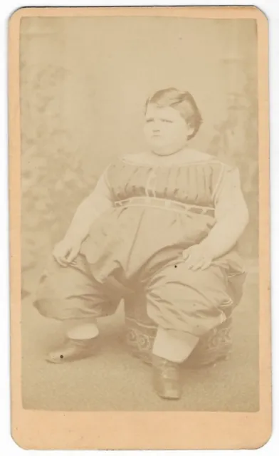 Antique CIRCUS FAT BOY Samuel Bishop SIDESHOW Freak Show ORIGINAL CDV PHOTO