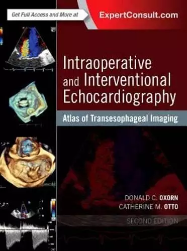 Intraoperative and Interventional Echocardiography: Atlas of Transesophageal