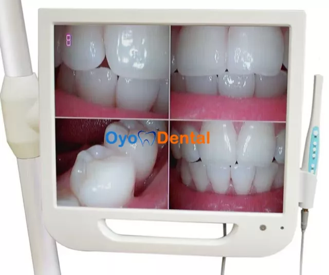 Dental Intra-oral Camera Wifi Digital 17 Inch Monitor High Definition 1/4 CCD