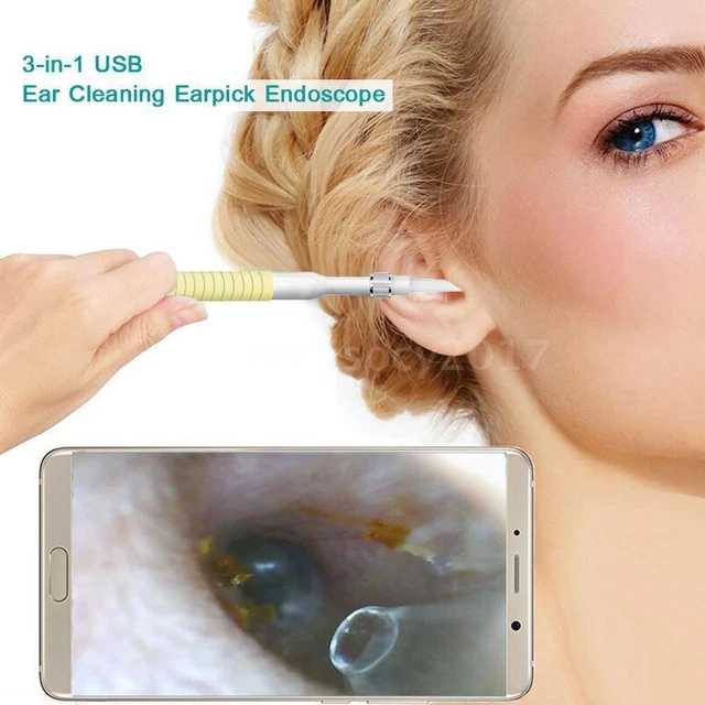 Ear Wax Remover Camera Endoscope – Otoscope Cleaning Kit With Spoon Pick (New, No Box) - View #5