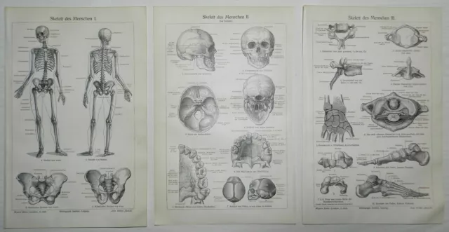 SKELETT  Mensch I - III Gerippe  Anatomie Knochen Orthopädie Lithographie 1908