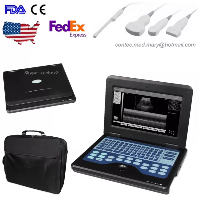 10.1 Inch Portable Ultrasound Scanner Laptop Machine CMS600P2 For Human FDA CE