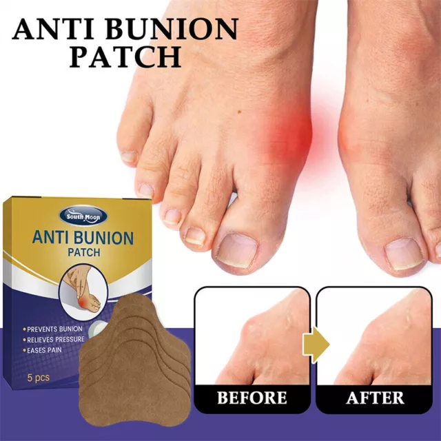 Patch Anti-Oignon Pour Articulations Fortes Correcteur D'oignon Reli Bunion R