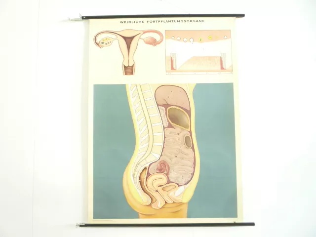 Schulwandkarte Lehrkarte Weibliche Fortpflanzungsorgane Biologie von 1969. TOP