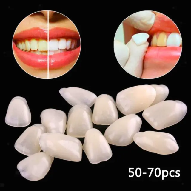 Set faccette temporanee – Pro Teeth Upper resina sintetica beige