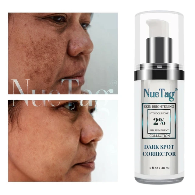 2 HYDROQUINONE DARK Spot Corrector Remover Face & Melasma Treatment