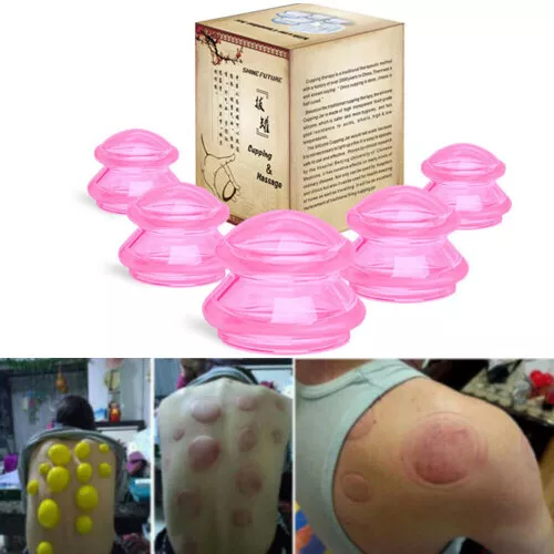 Set 5PCS Silicone Medical Vacuum Massage Cupping Cups Therapy Anti Cellulite