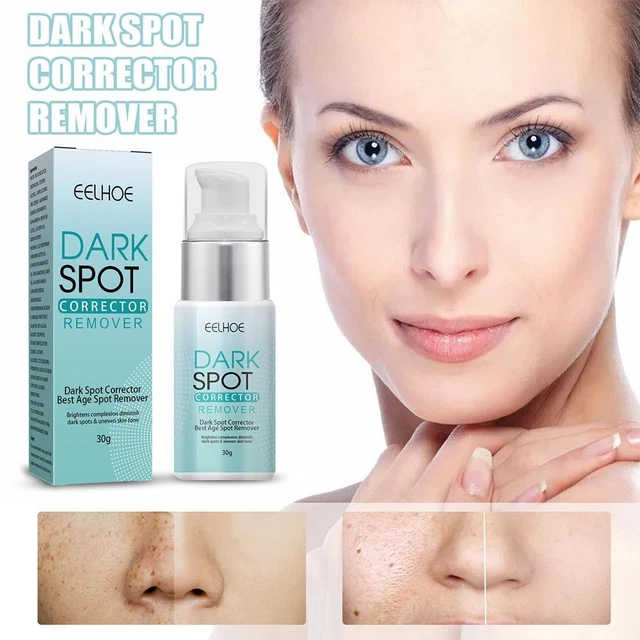 Crema aclaradora y eliminación de pecas crema mancha negra crema